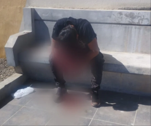 Cochabamba: Un hombre fue apuñalado en la cabeza por su pareja